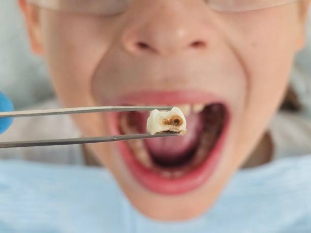 Professional Emergency Dental Service in AL